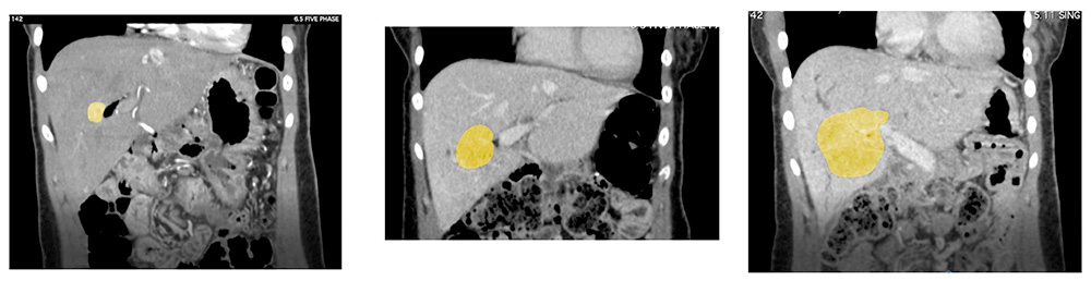 CT image examples of diagnostic errors