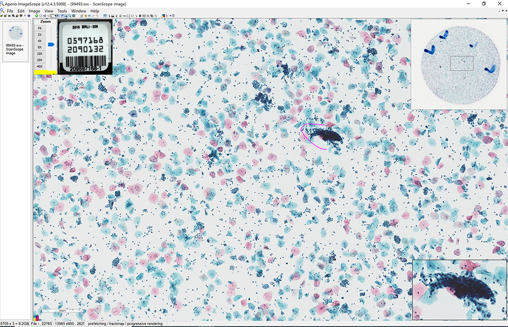 Imaging example of laboratory errors