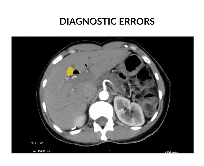 diagnostic errors