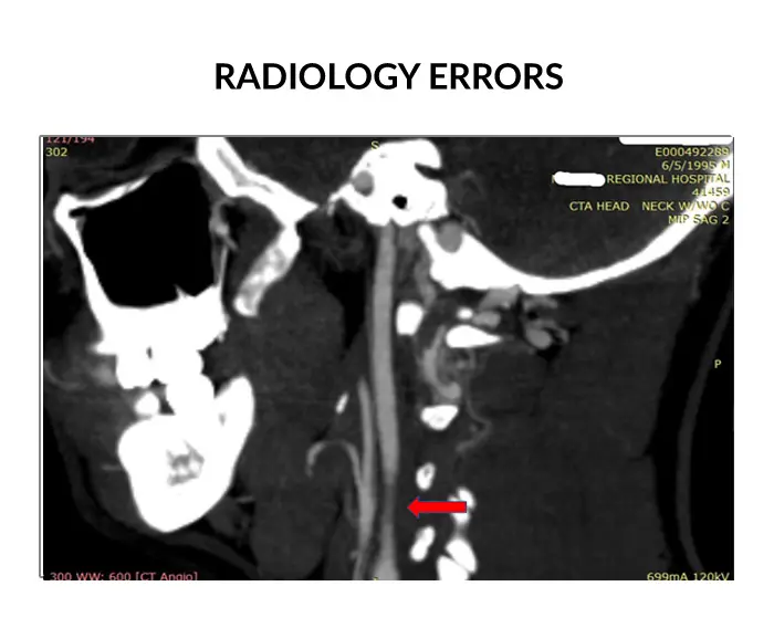 radiology errors