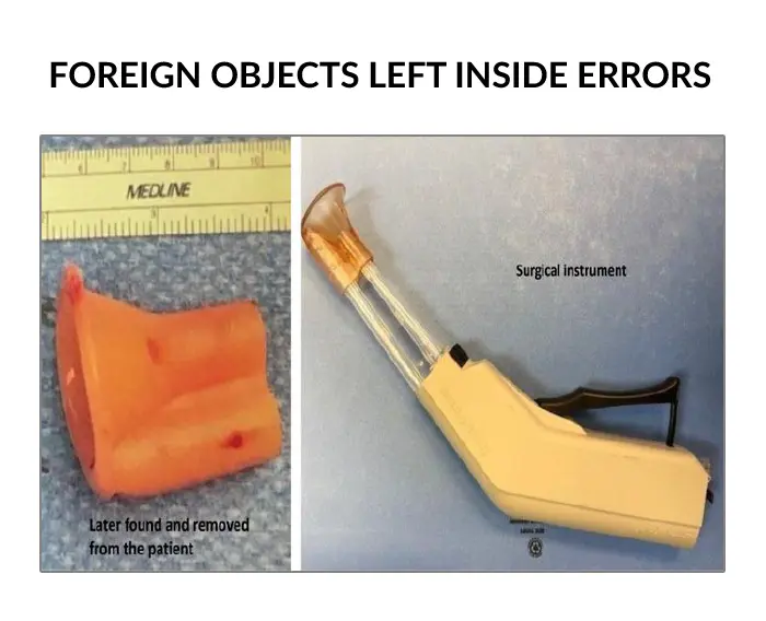 foreign objects errors