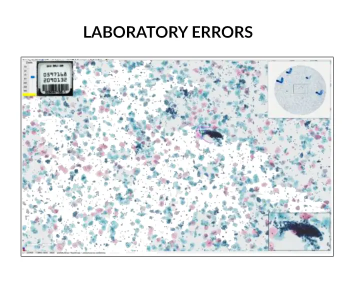 Laboratory errors